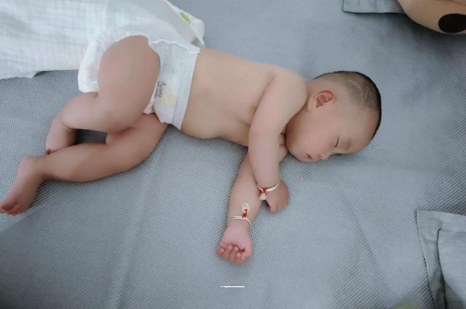 茂名六个月宝宝眼睛散光